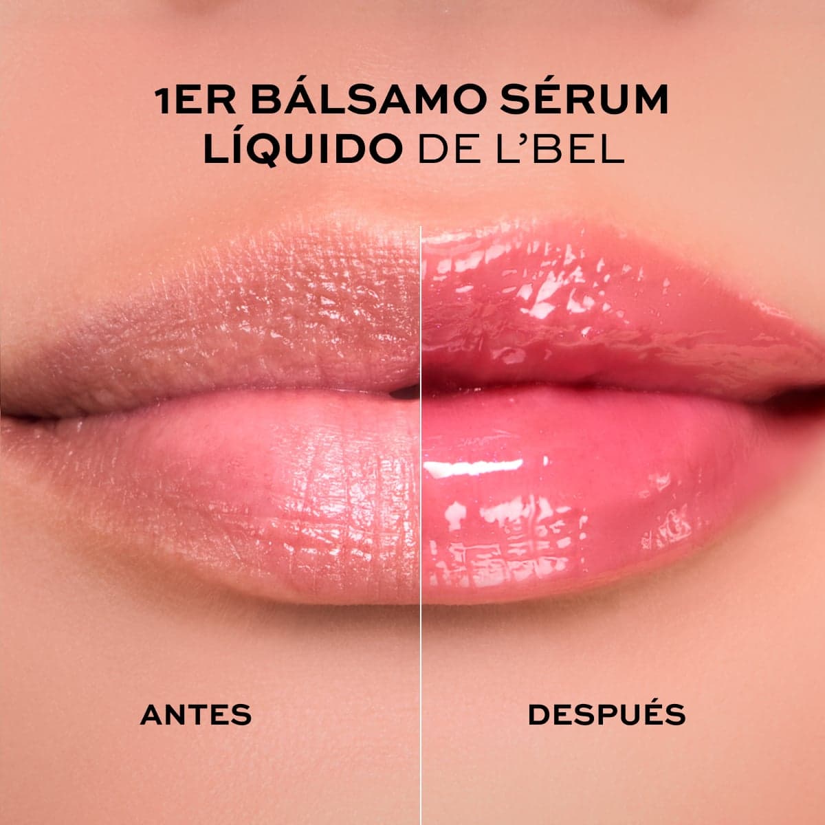Labial Solutions Pro-Hialuron Lip Treatment 10g. e 35 oz. thumbnail 2